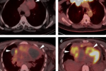 Fraudulent Healer Allegedly Claimed to Cure Cancer Through Body Scans