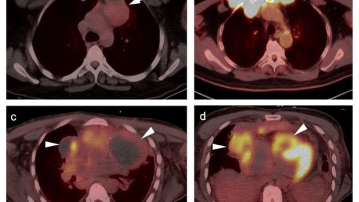 Fraudulent Healer Allegedly Claimed to Cure Cancer Through Body Scans